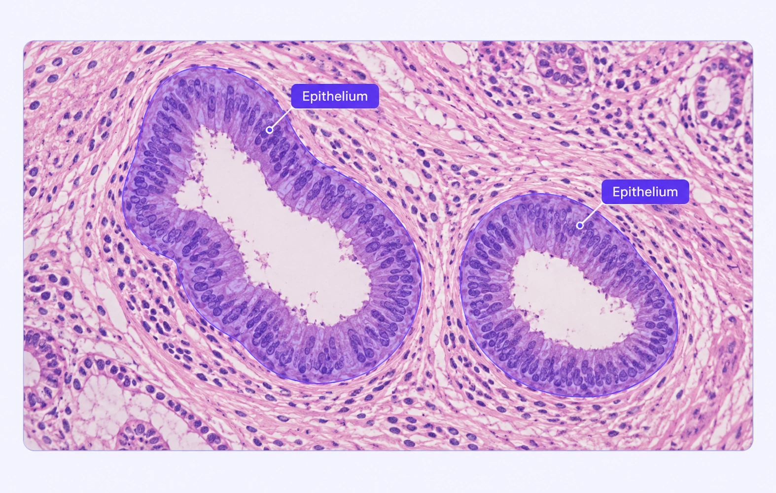 Histology with epithelial tissue regions segmented. Histology with epithelial tissue regions segmented.