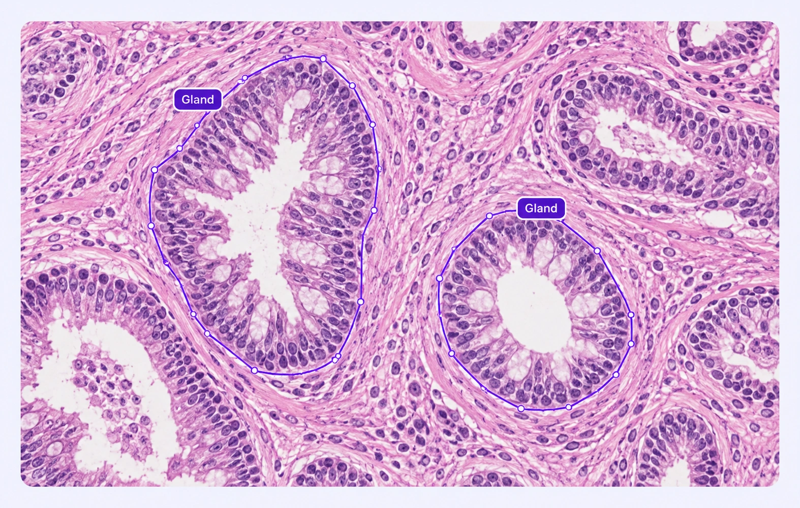 Histology with gland boundaries outlined. Histology with gland boundaries outlined.