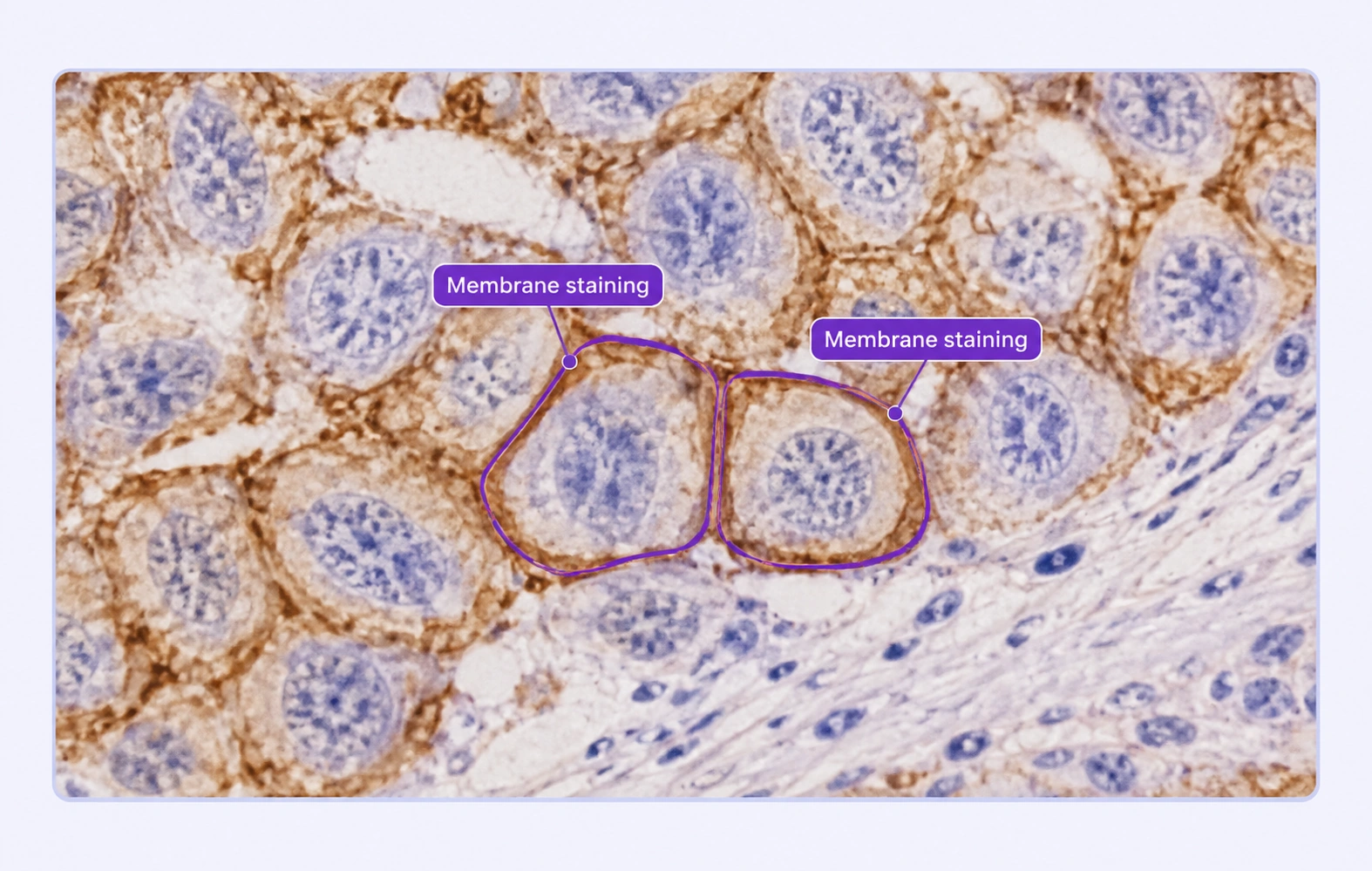 IHC cellular regions labeled for membrane staining.