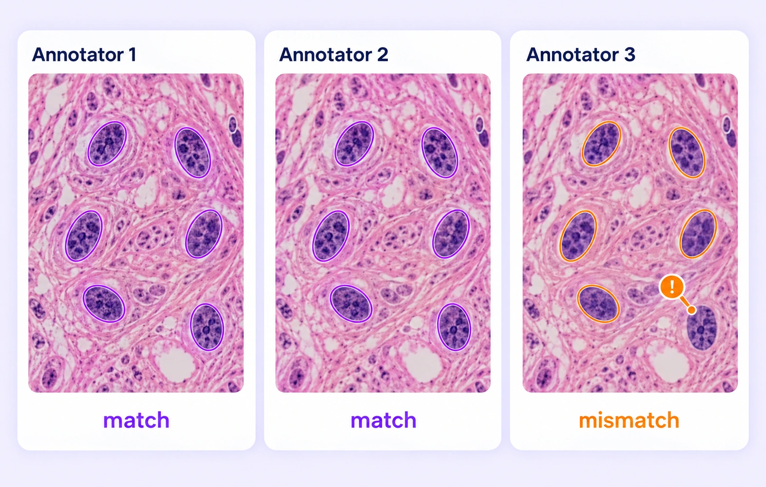 Independent labels on the same histology region expose an omitted nucleus annotation. Independent labels on the same histology region expose an omitted nucleus annotation.