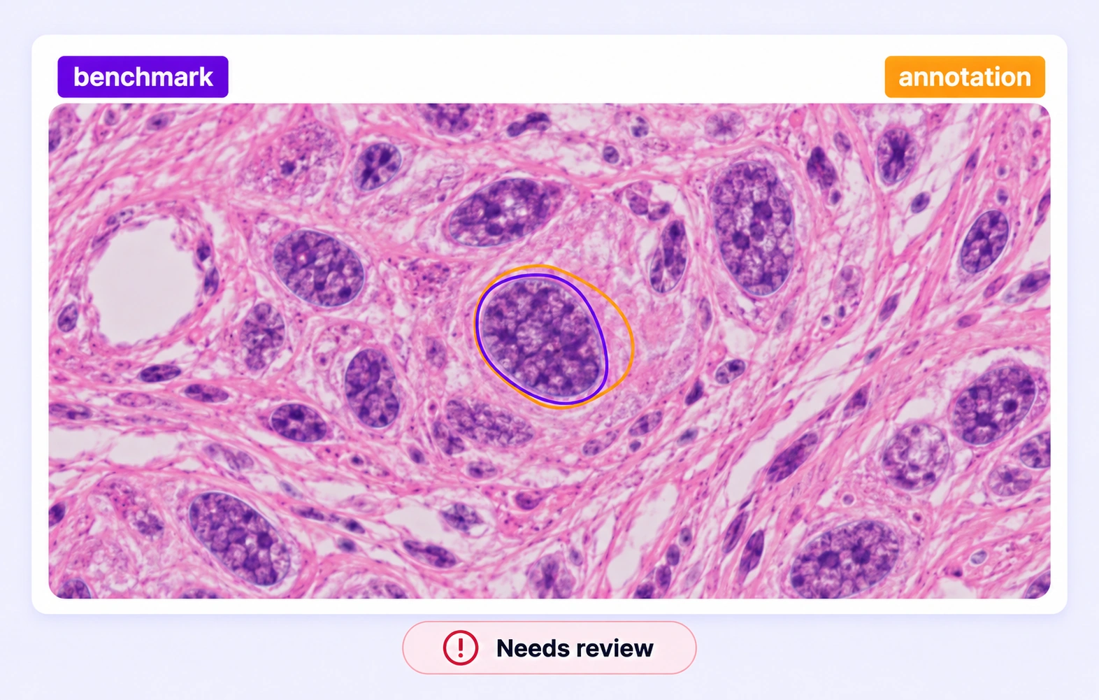 A nucleus contour extending into cytoplasm is compared with the approved microscopic benchmark. A nucleus contour extending into cytoplasm is compared with the approved microscopic benchmark.