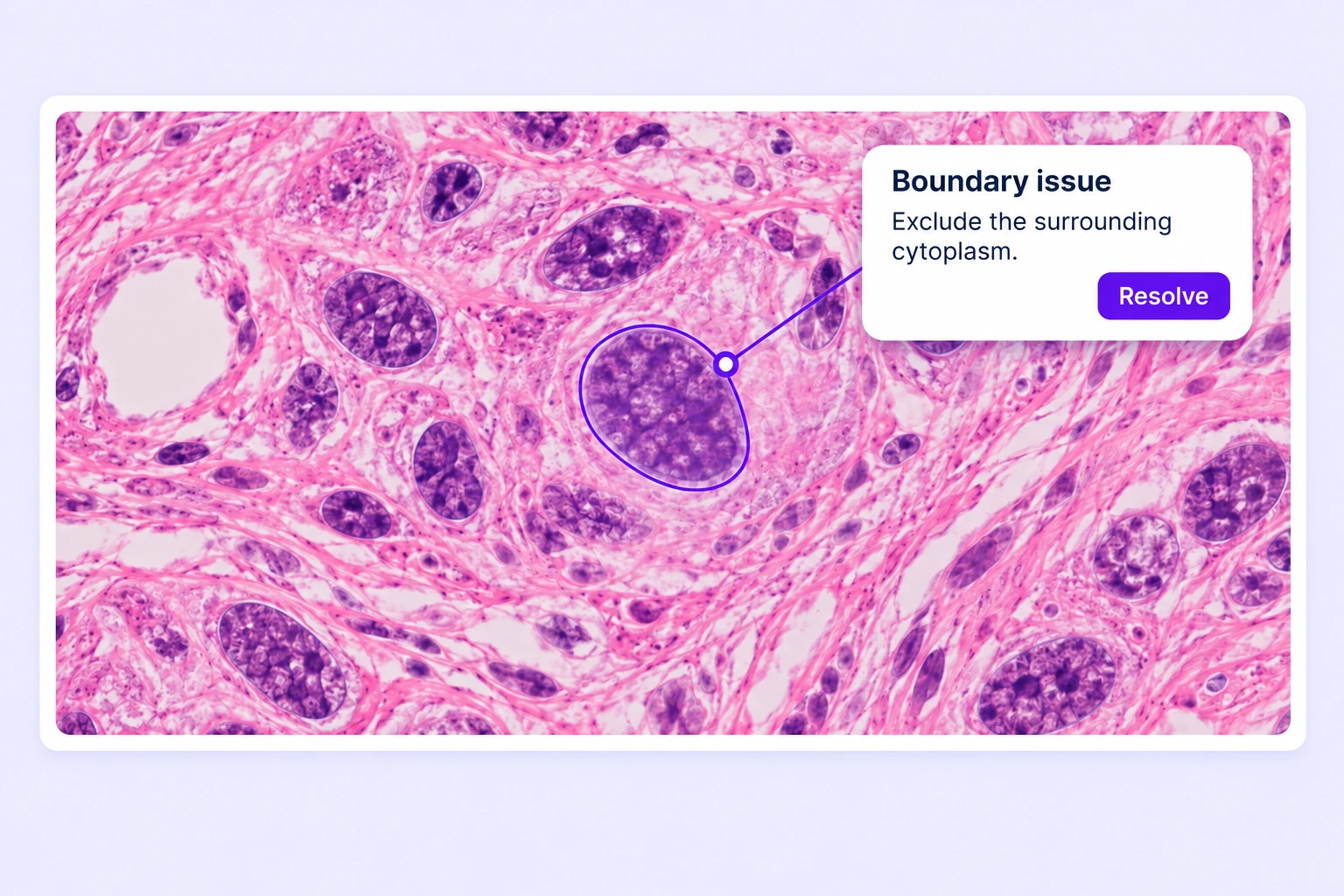 A review issue connects to a nucleus contour with an instruction to exclude surrounding cytoplasm and a Resolve action.