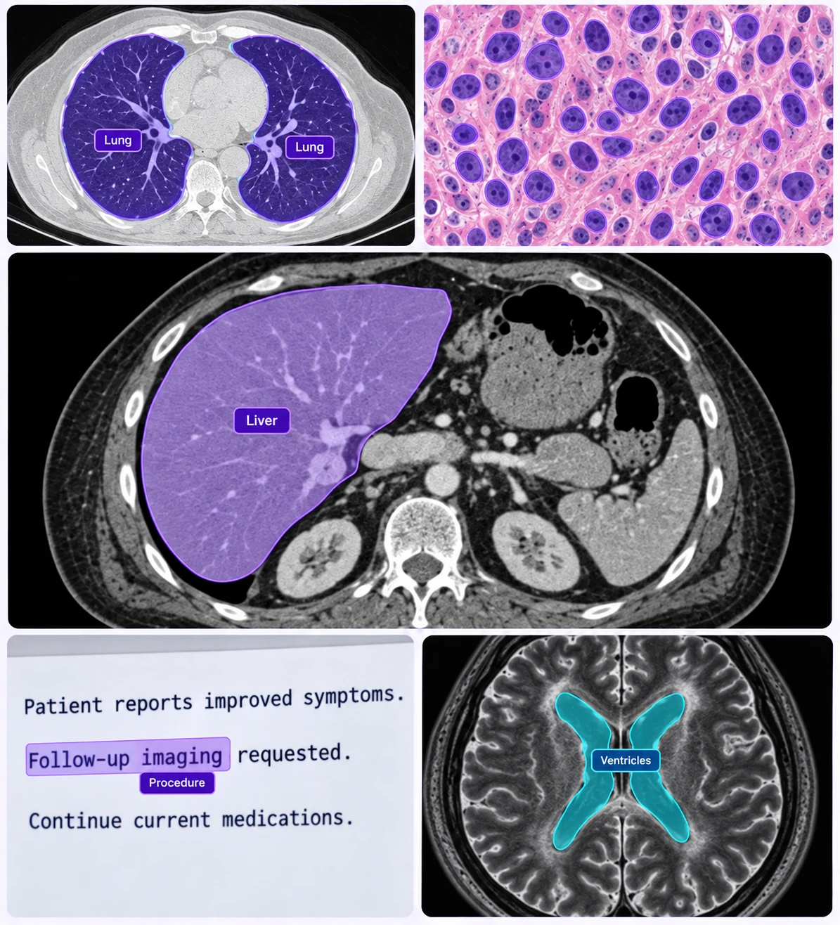 CT lung and liver segmentation masks, pathology nuclei masks, clinical text spans, and brain MRI ventricular regions