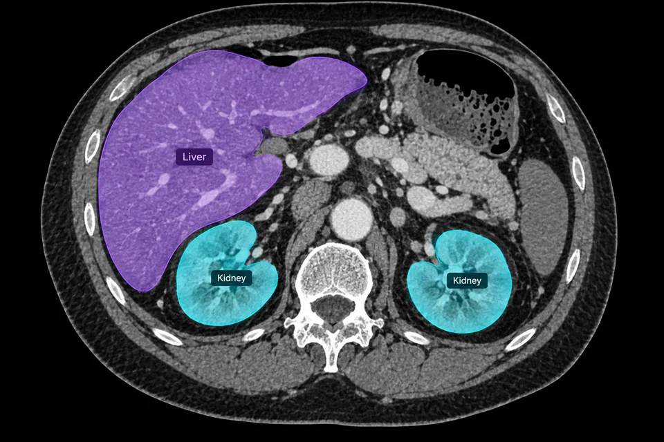 health annotation example