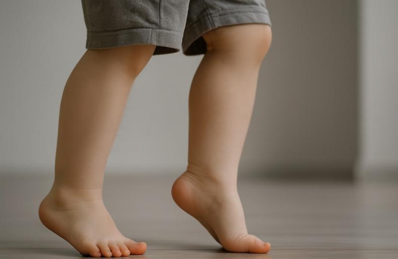 A Importância da Análise Tridimensional da Marcha no Pé Equino Idiopático Infantil