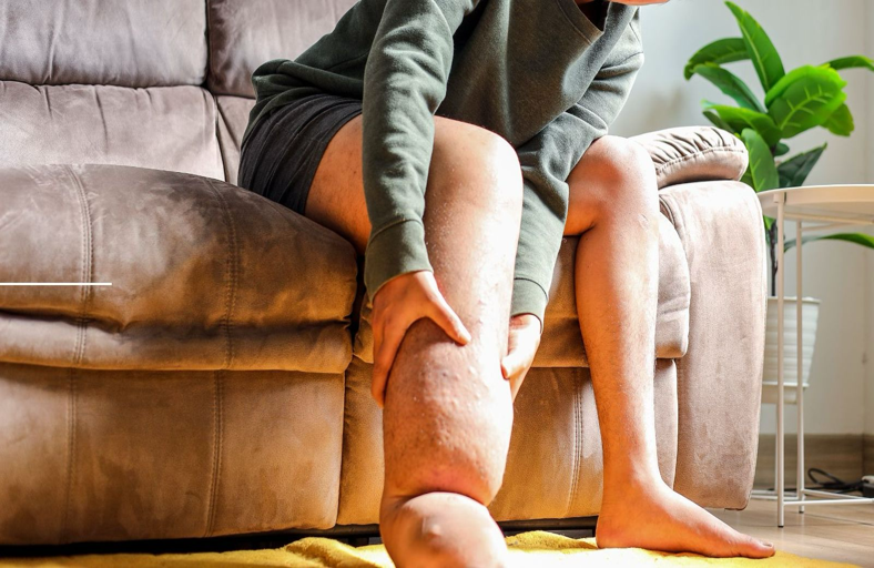 Alterações Biomecânicas no Linfedema de Membros Inferiores e o Papel da Terapia Física Complexa Descongestiva