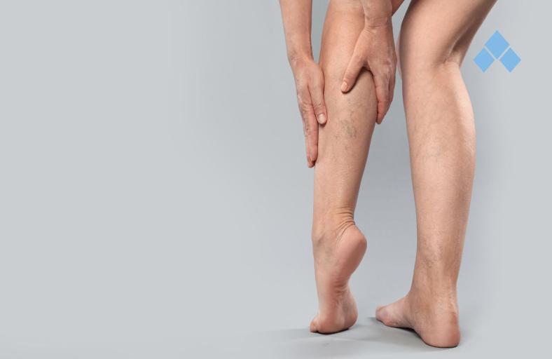 Fisioterapia nas Disfunções Linfáticas e Vasculares: Uma Abordagem Integrativa, Funcional e Baseada em Evidências