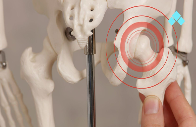 Por que Pacientes com Dor no Quadril Precisam Analisar o Movimento Antes de Tratar?