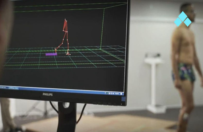 Análise Biomecânica 3D: Como a Tecnologia Revoluciona o Tratamento de Condições Musculoesqueléticas