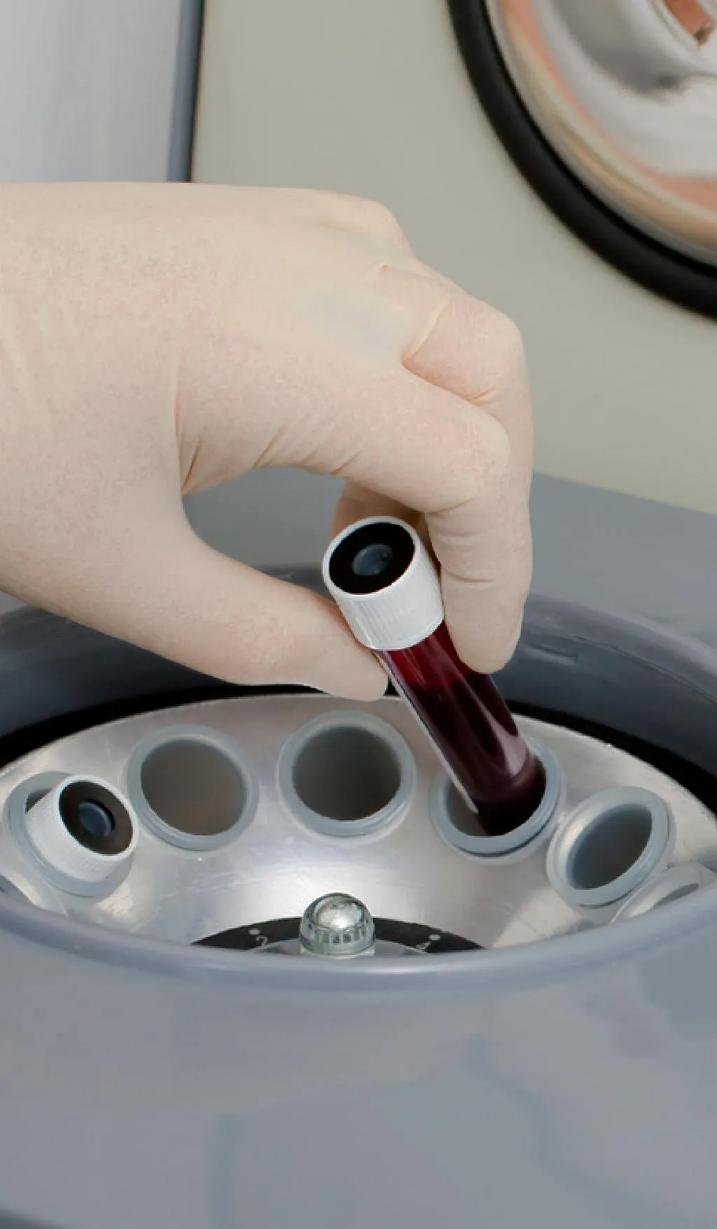 Zentrifuge aus der eine Röhrchen mit Blut zur Eigenbluttherapie entnommen wird.
