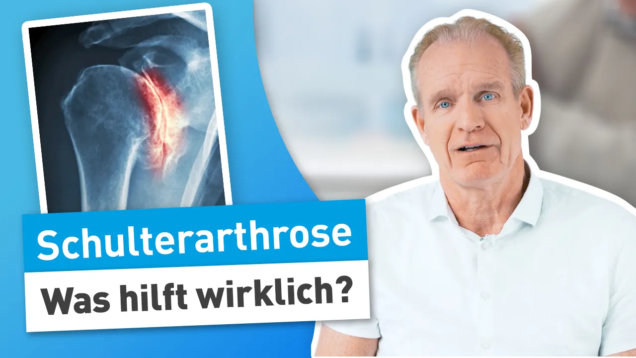 Schulterarthrose selbst behandeln: Bewegung statt Schonung!