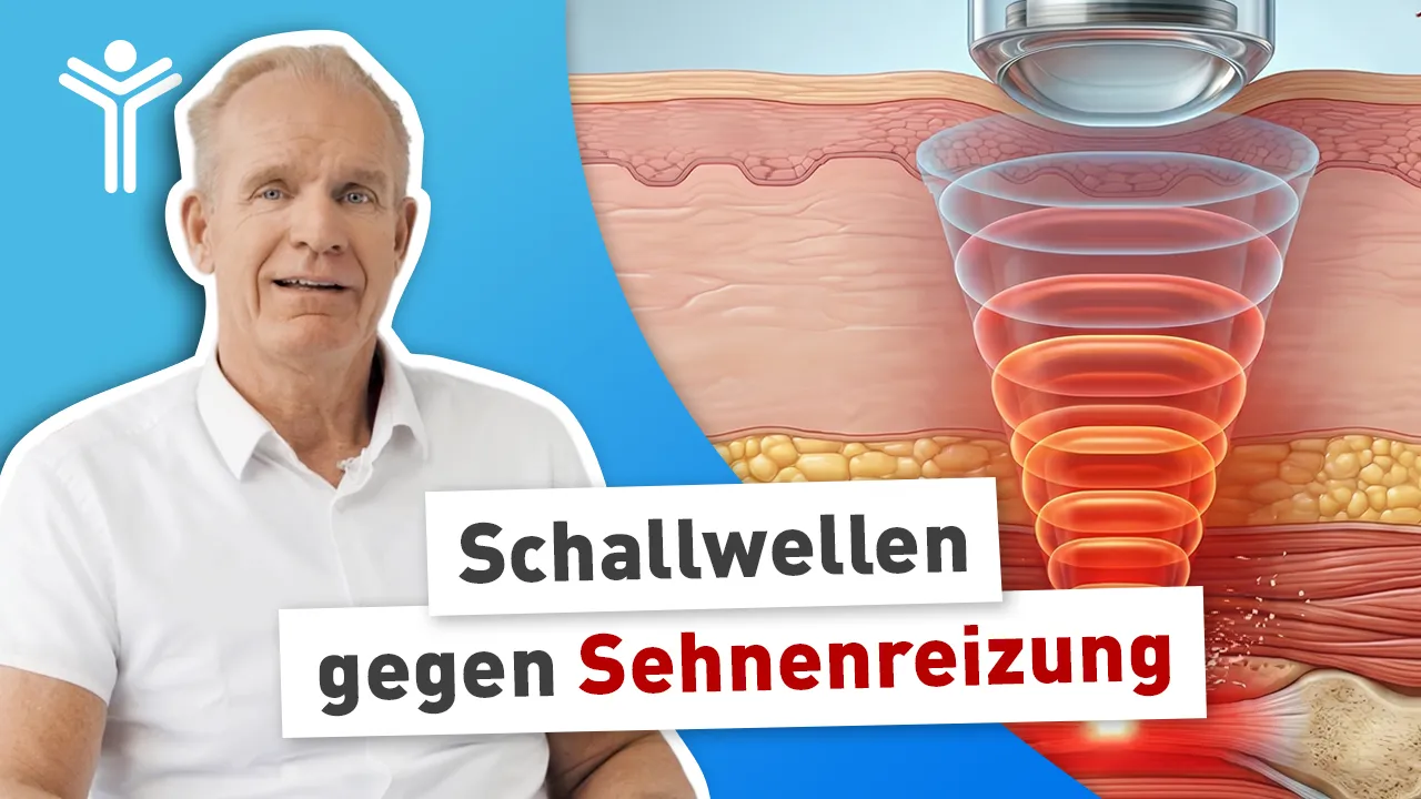 Stoßwellentherapie einfach erklärt: Tennisarm, Fersensporn & Co. natürlich behandeln
