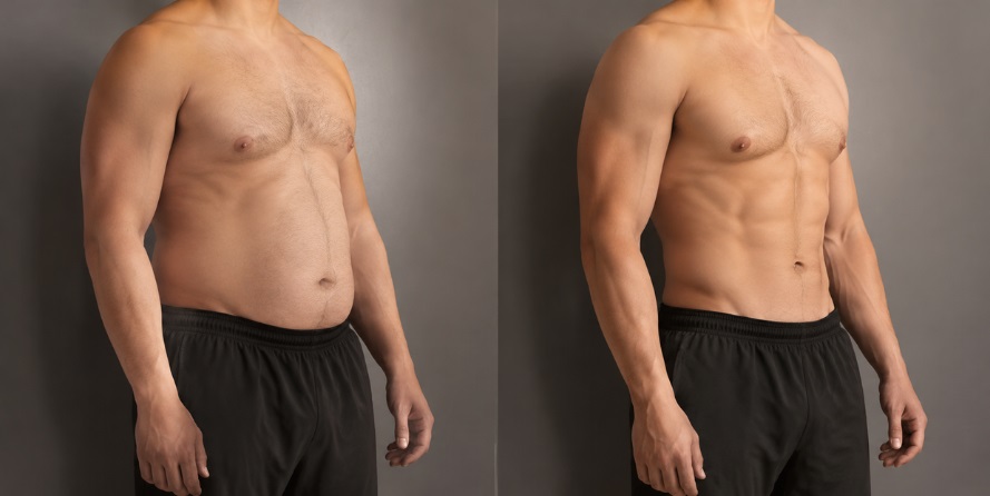 Sermorelin Before and After: A Realistic Week-by-Week Look at Results