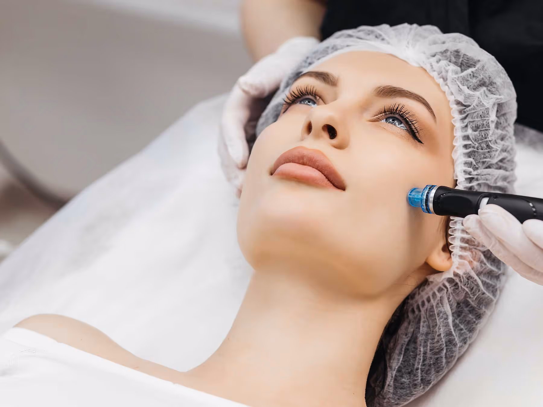 Microneedling in Düsseldorf