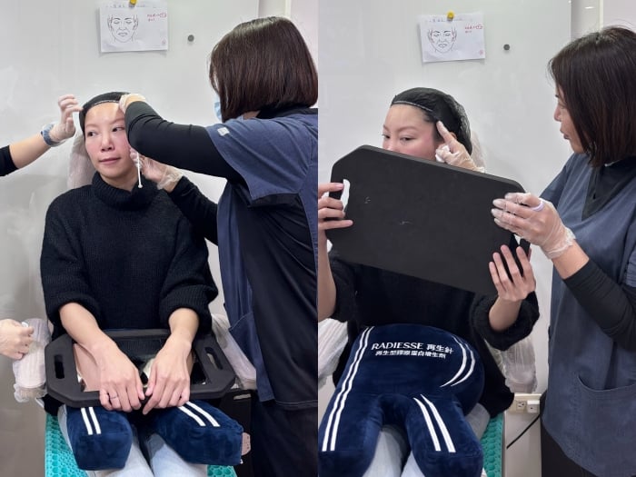 維昕診所,劉思慧醫師,再生針