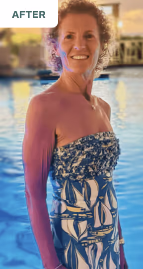 sharon, after picture