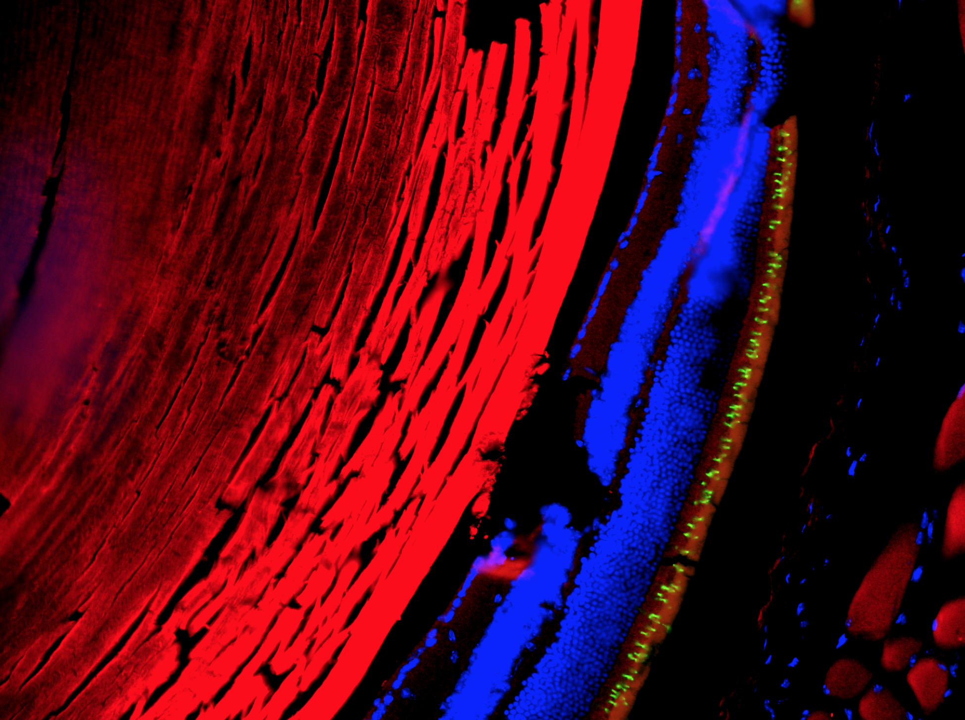Microscopic cross-section of a retina showing layered tissue stained in red, blue, and green highlights.