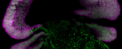 Microscopic image showing purple-stained layered tissue structures surrounding a central dark area with scattered bright green fluorescent spots, suggesting biological or cellular components under fluorescence microscopy.