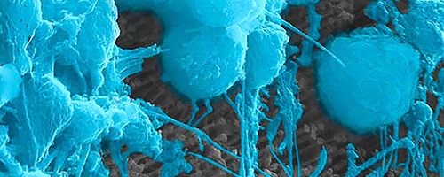 Nanotech Retina
