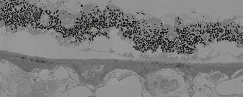 Black and white microscopic image showing a densely packed layer of small, dark, rounded cellular structures along a lighter background with varying textures and shapes beneath it.