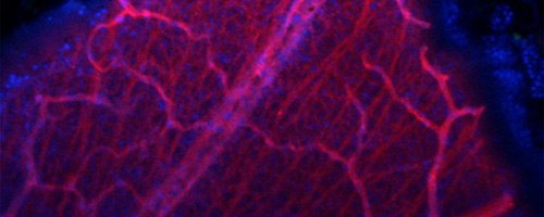 Microscopic image showing a network of red and pink blood vessels on a dark blue background, highlighting fine vascular structures.