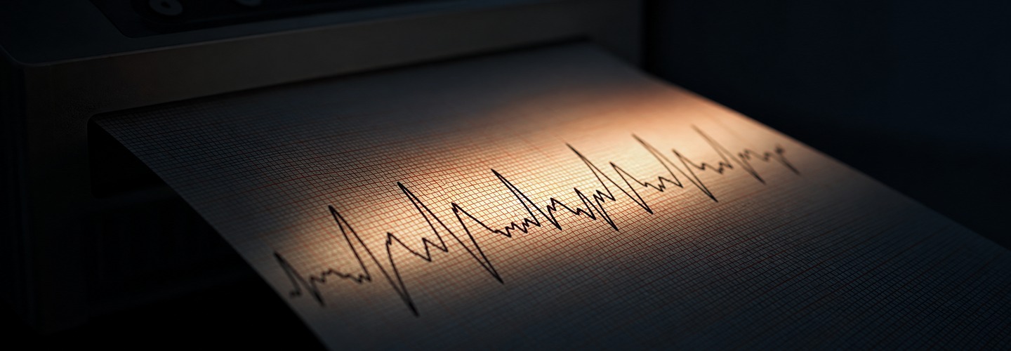 Irregular Heartbeat: When to Worry and What It Means