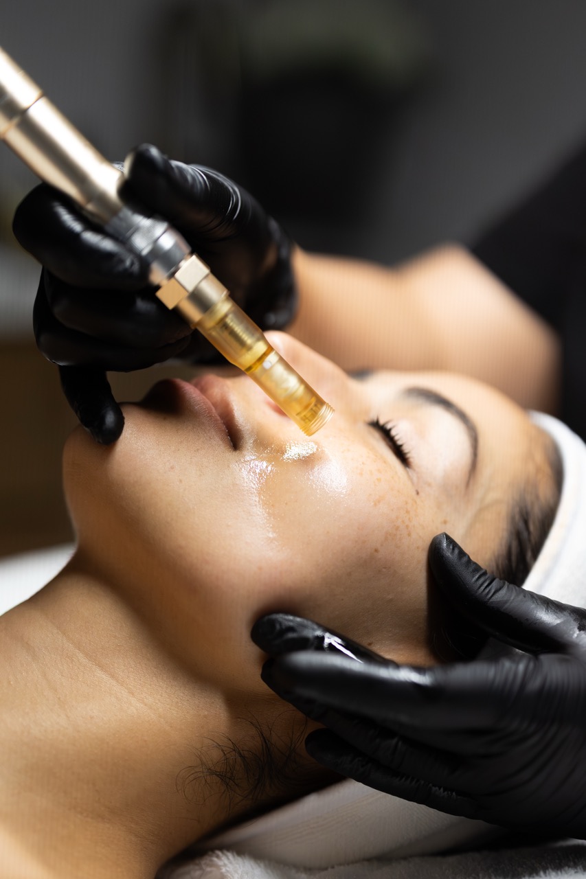 Girl Face Glow After Getting Dermal Fillers