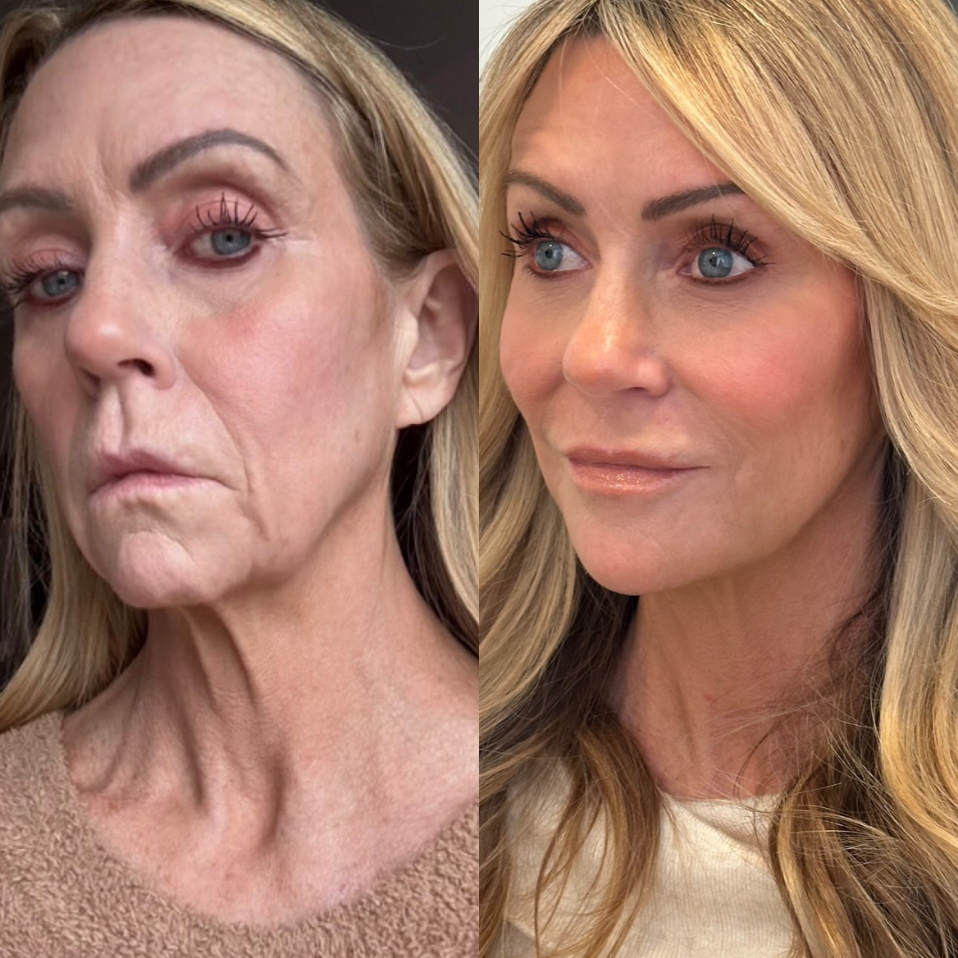 Park patient results