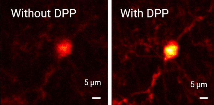 Upgrade of a two-photon microscope