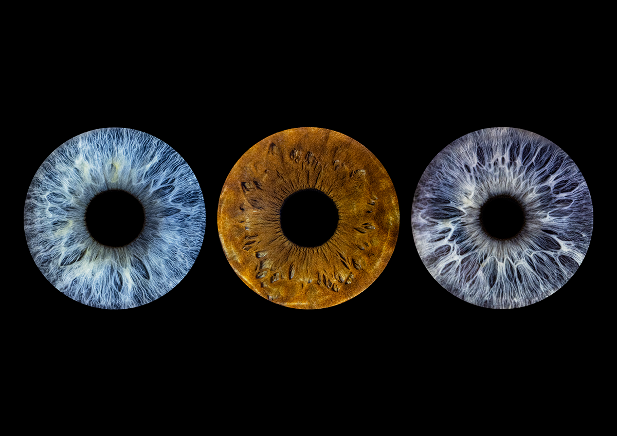 Triple simple no aura iris style