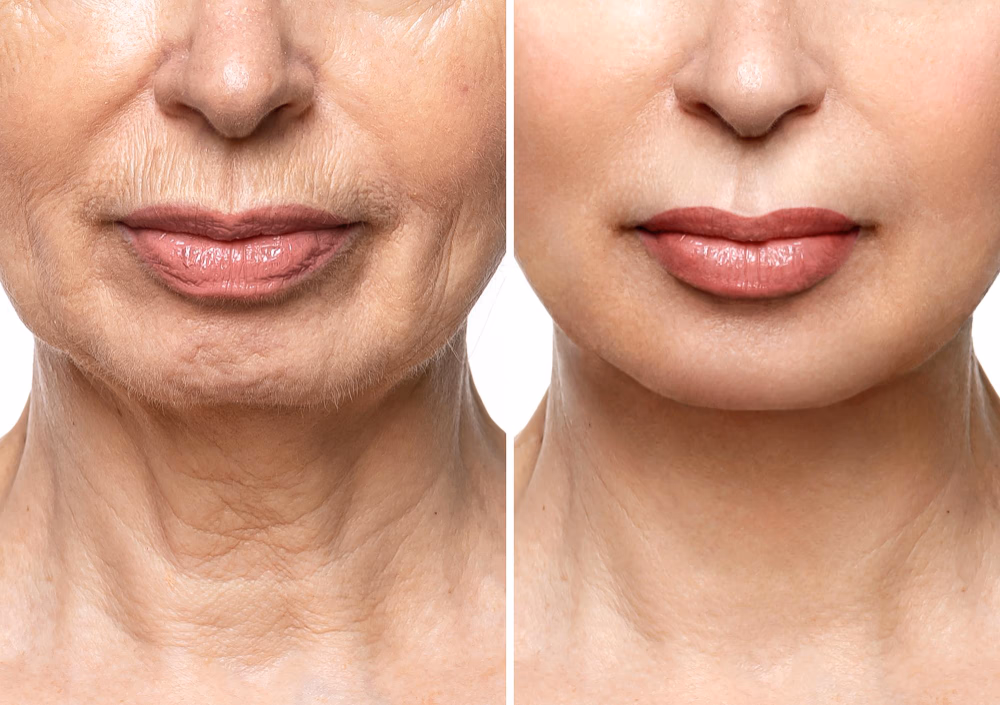 Dr. Margarete B. Vorher/Nachher