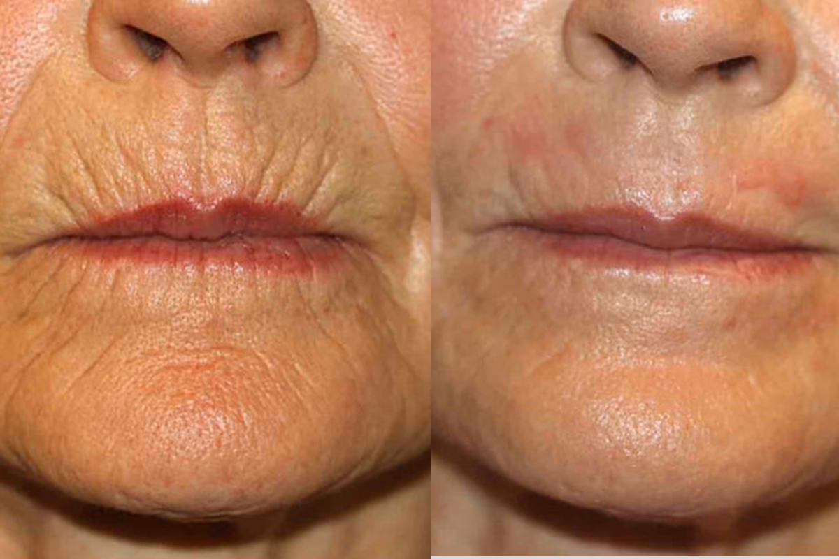 Maria S. Vorher/Nachher