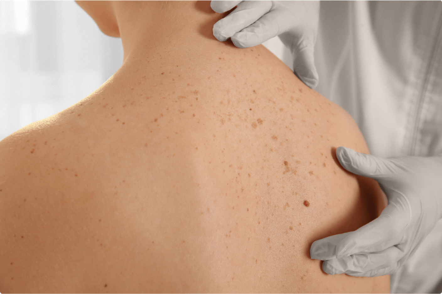 Dermatologie_Online_Fortbildung