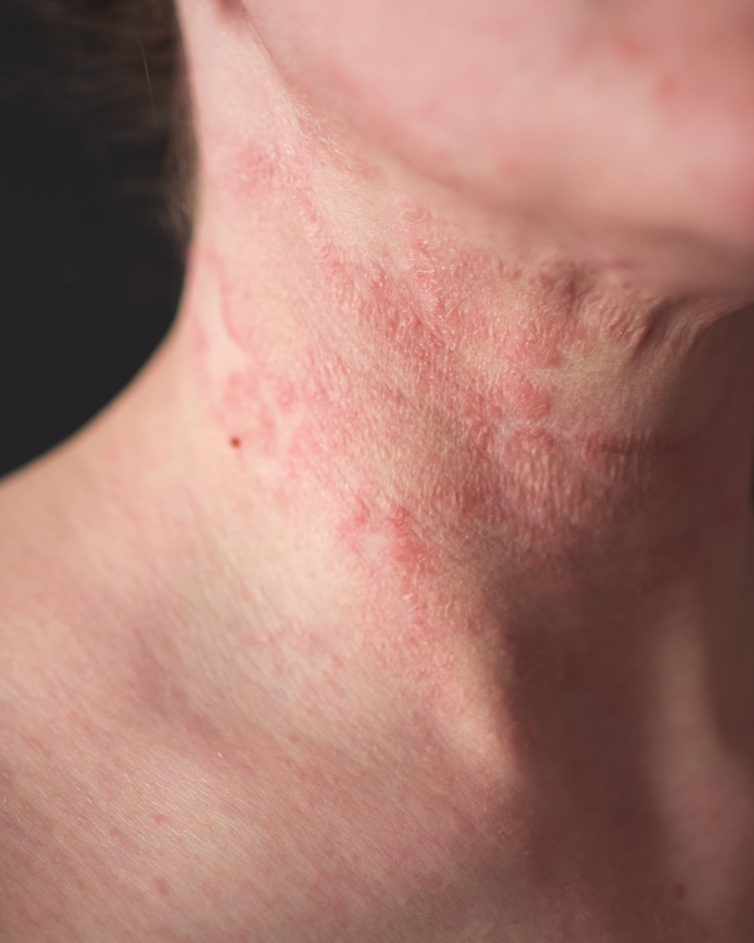 Medical Consultation