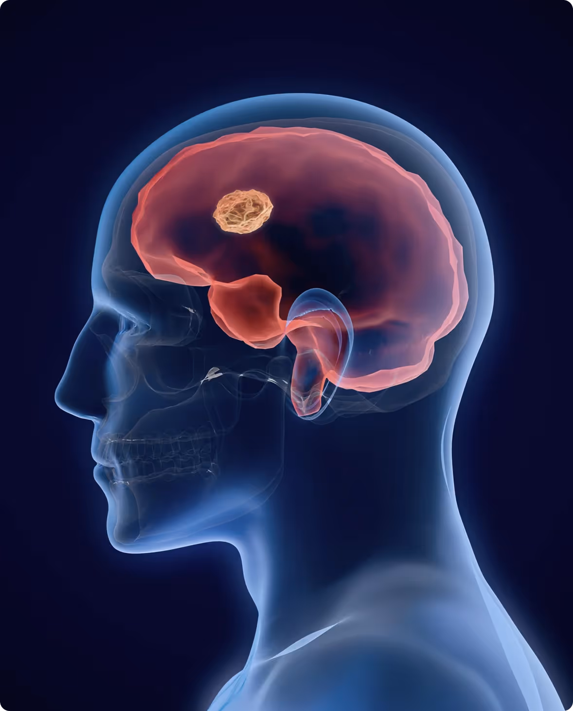 X-ray image showing a human brain injury