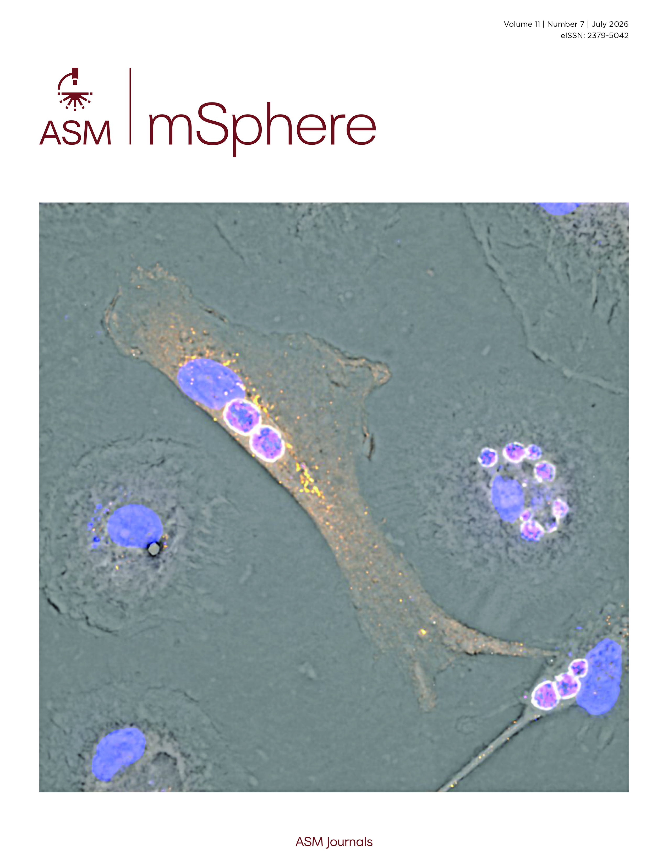 Applying PCR cycle autonormalization to improve PacBio full-length 16S rRNA sequencing