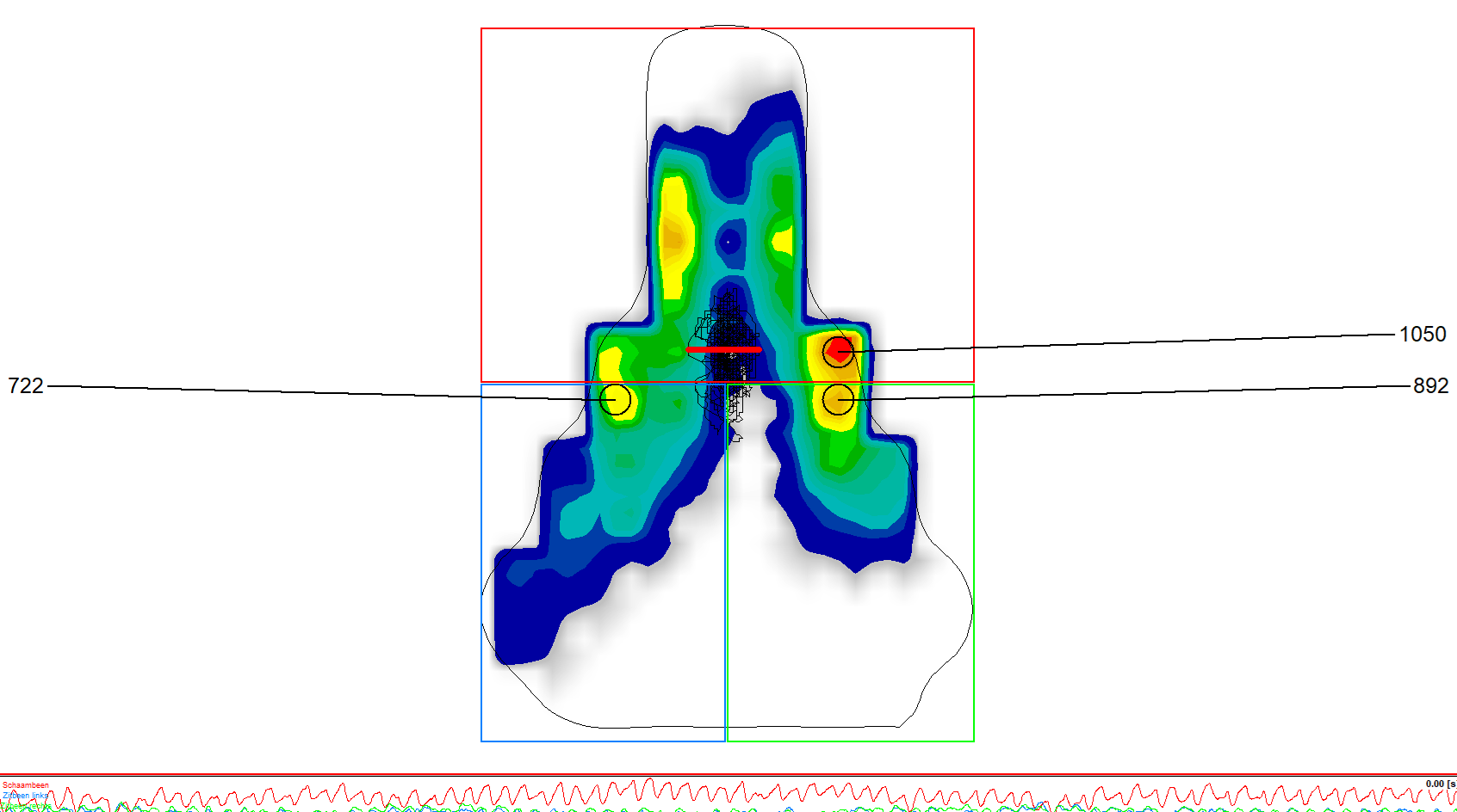 zadeldrukmeting Perima