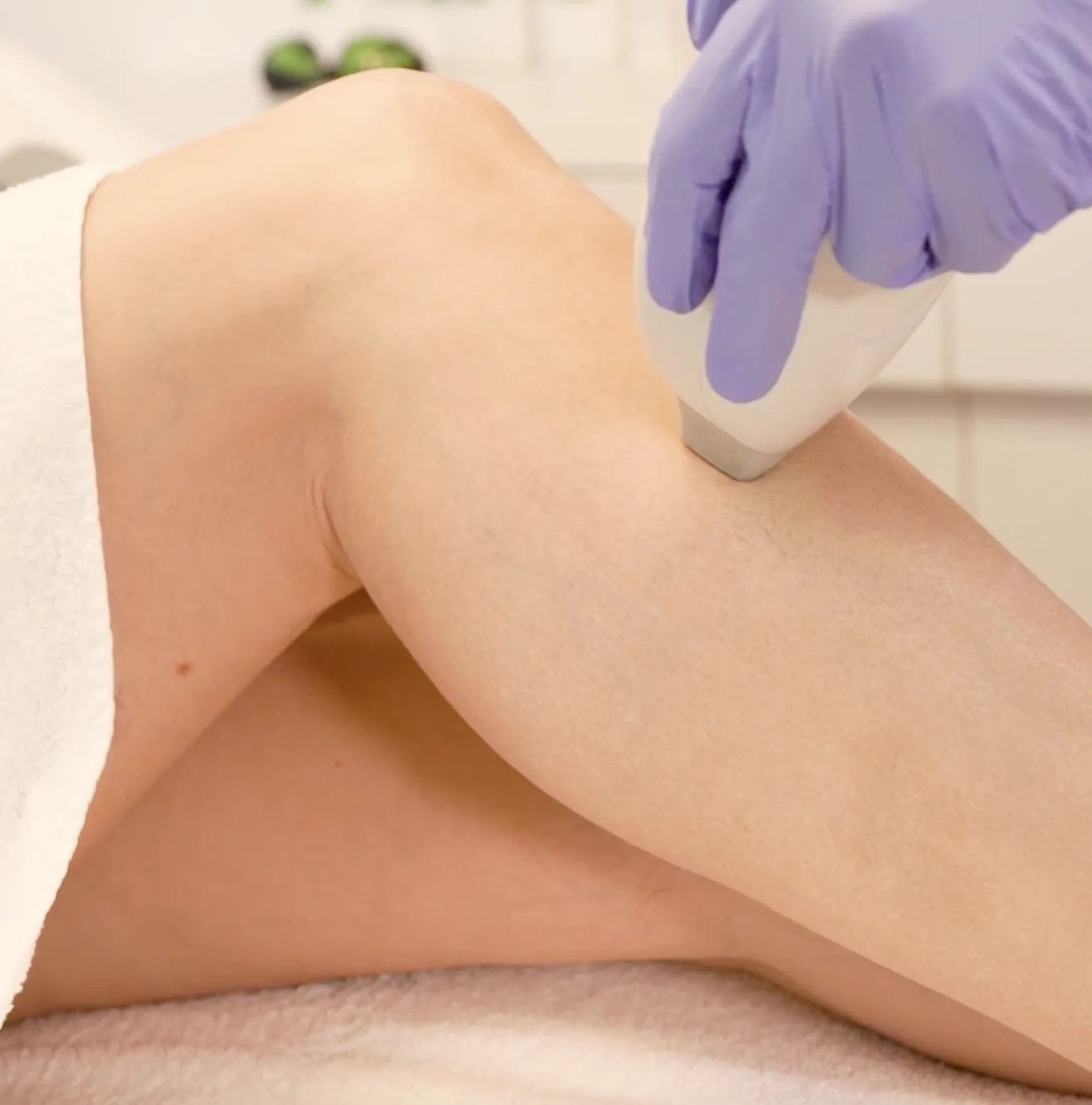 Bein das gelasert wird bei LUXBODY