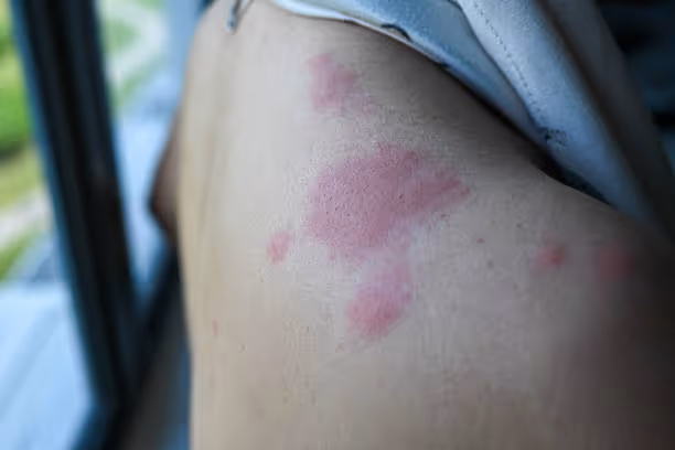 istockphoto-2215054890-612x612
