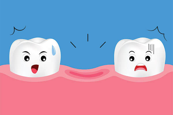 Going to an Emergency Dentistry Clinic During COVID-19 for a Knocked-Out Tooth