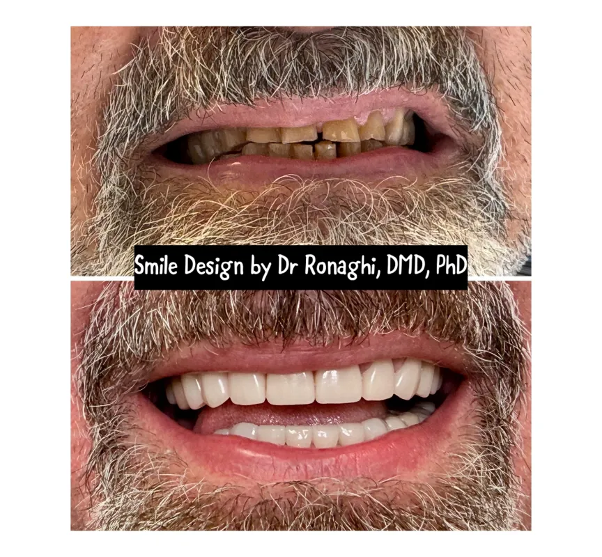 Creek 75 Dental Group, Before and After Dental Treatment