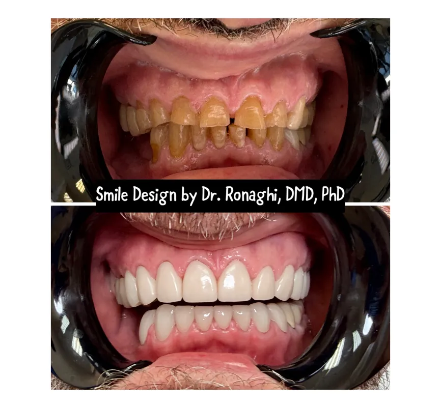 Creek 75 Dental Group, Before and After Dental Treatment