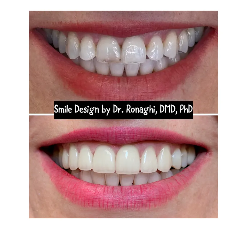 Creek 75 Dental Group, Before and After Dental Treatment