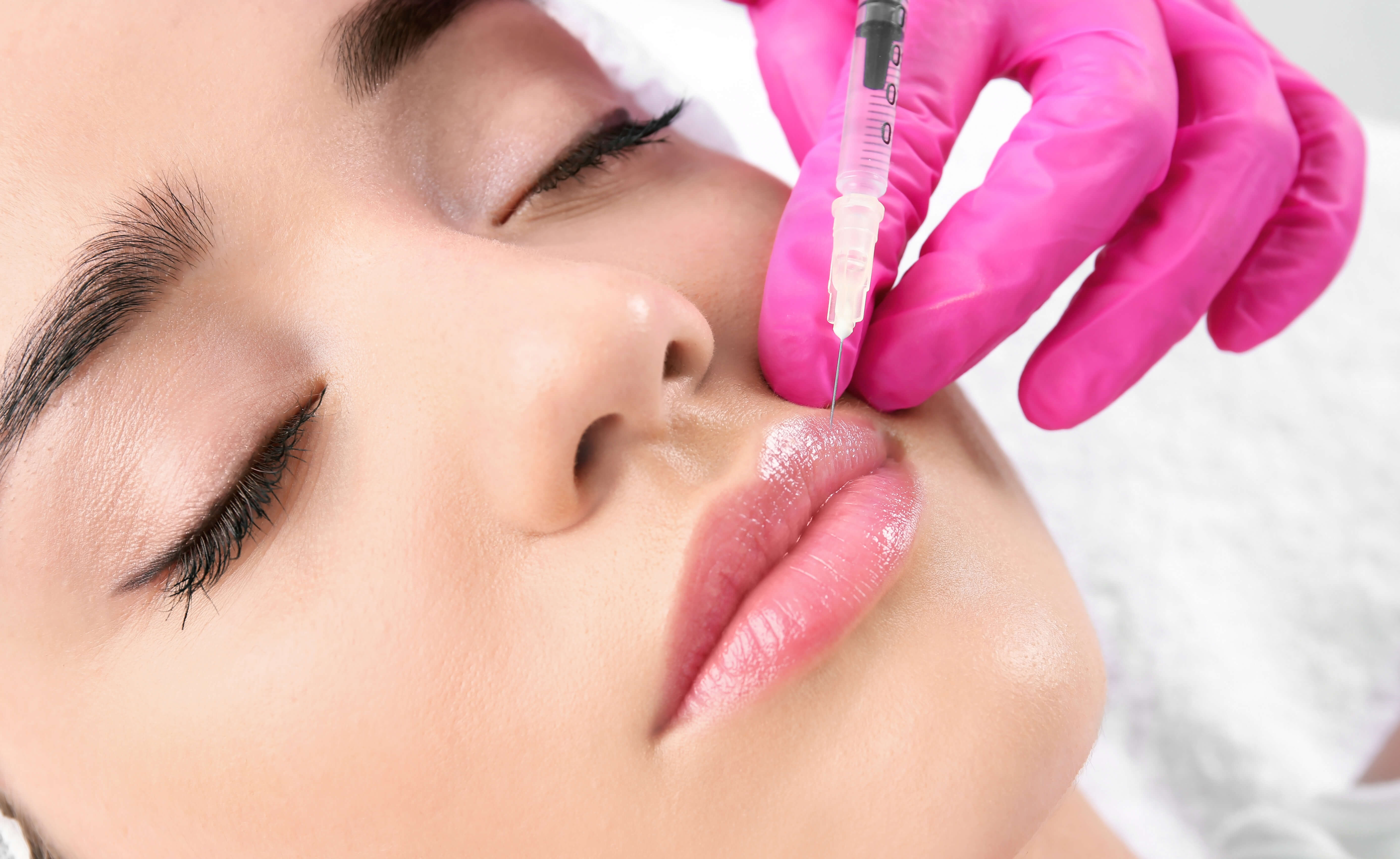 Dentist performing botox and dermal filler to improve gummy smile and lip balance