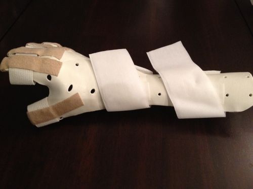 Hand splint