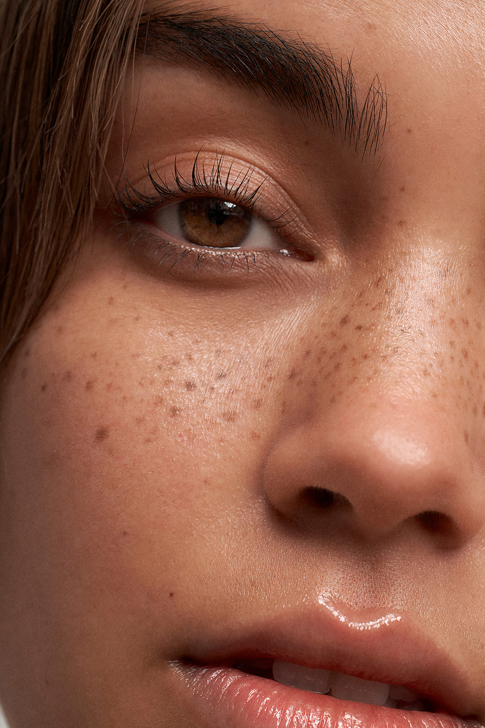 A woman with freckles on her face.