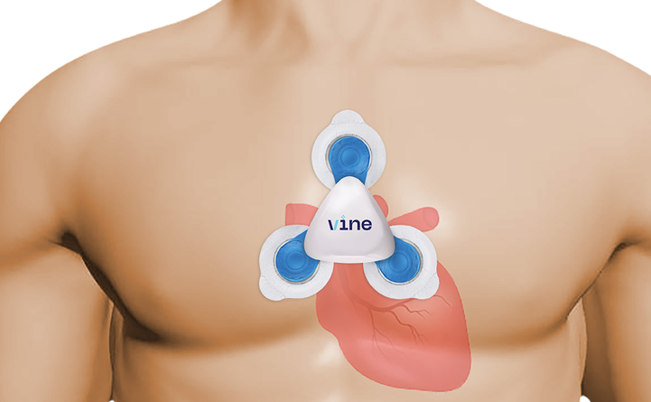 Holter Monitors