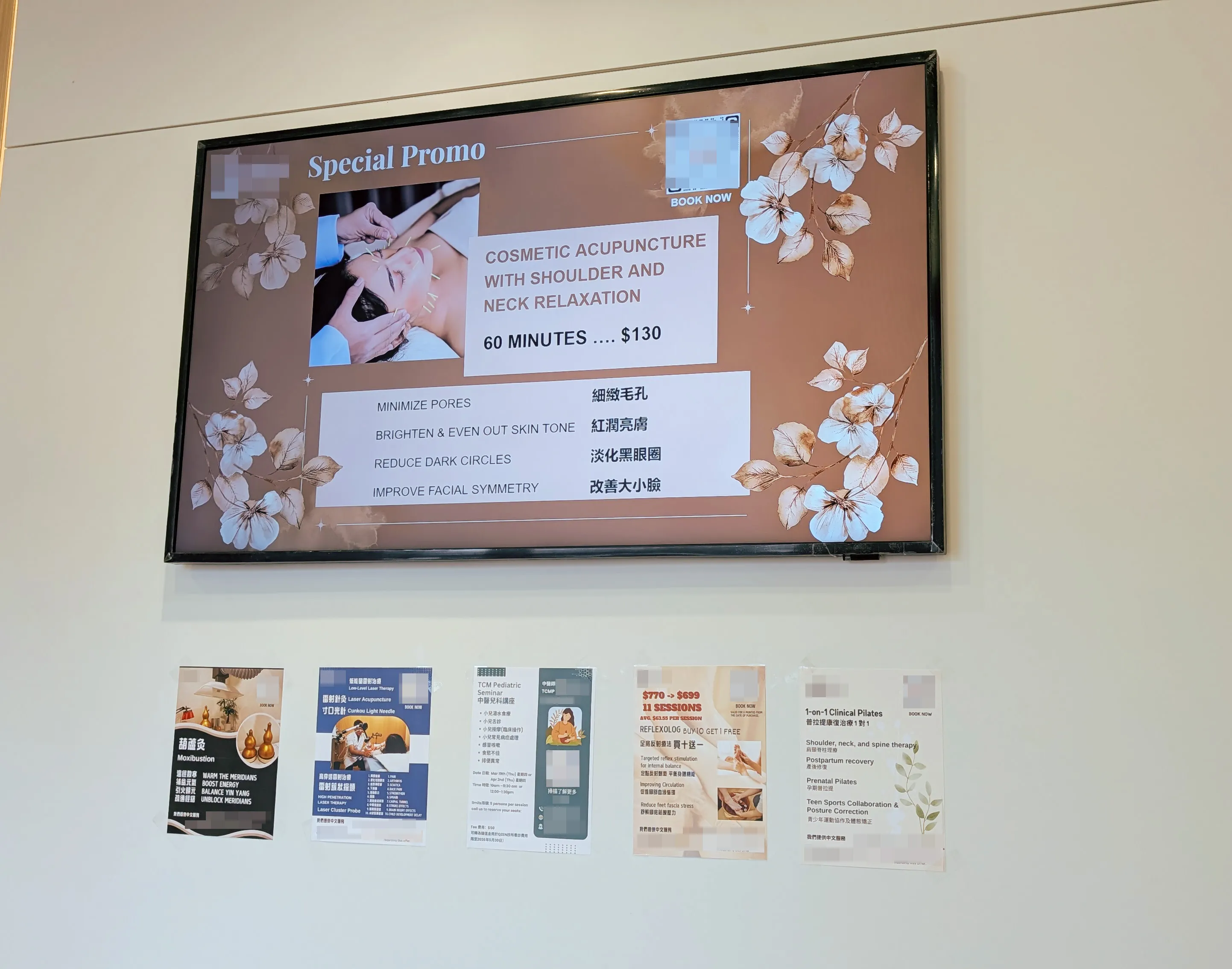 Wall-mounted screen displaying a special promo for cosmetic acupuncture with shoulder and neck relaxation, 60 minutes for $130, with benefits listed including minimizing pores, brightening skin tone, reducing dark circles, and improving facial symmetry, decorated with floral patterns.