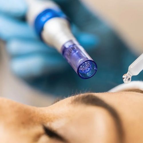 BB Glow Special: The Safest September Skin Treatment đź’›
