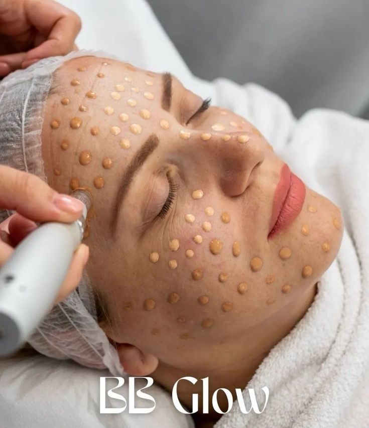 BB Glow Treatment (save $170)